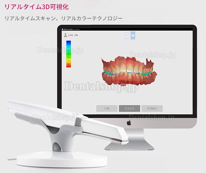 Runyes 3DS 歯科用デジタル口腔内スキャナー パウダーレスリアルカラースキャン